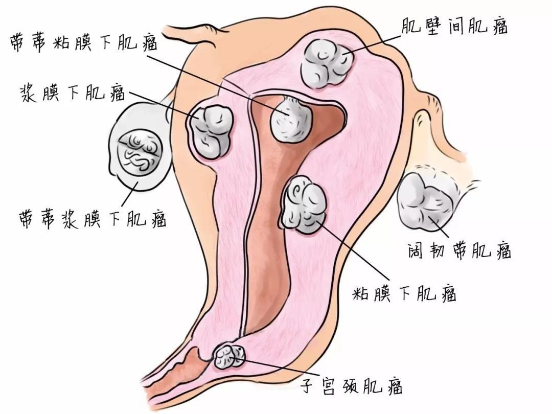 新澳门开奖结果2020+开奖记录__子宫肌瘤最新最好的治疗方法,深层设计策略数据_ios11.51.46